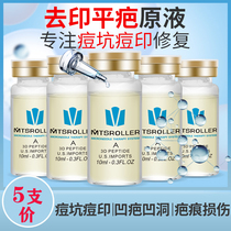 To print flat scar liquid To remove acne scar Acne pit printing pit pigmentation microneedle roller introduction of lyophilized powder ice film