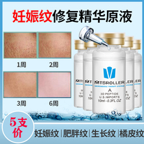 Professional removal of stretch marks liquid electric microneedle beauty plastic repair fat lines Body lines