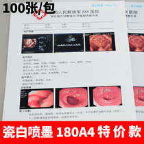 180μm医用超声瓷白喷墨胶片A4胶片胃镜B超四维彩超胶片打印纸100