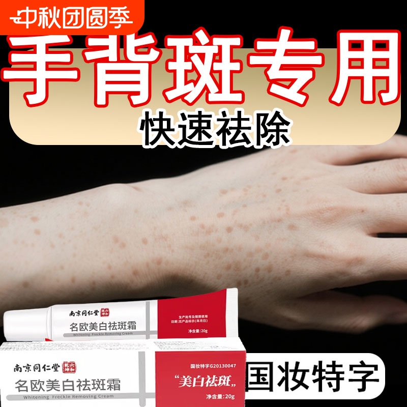 Cream to Remove Age Spots, Powerful Removal Cream for Face, Hands, and Arms, Specifically for Middle-Aged and Elderly People, for Dark Spots and Chloasma Cream to Remove Age Spots, Powerful Removal Cream for Face, Hands, and Arms, Specifically for Middle-Aged and Elderly People, for Dark Spots and Chloasma
