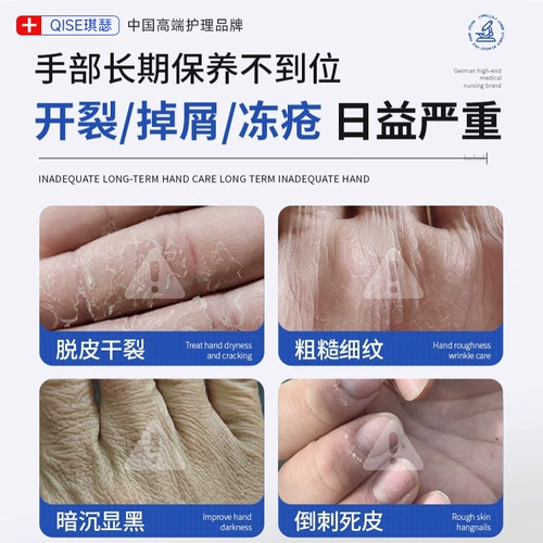 Мазь, крем для рук, восстанавливающий крем, против трещин