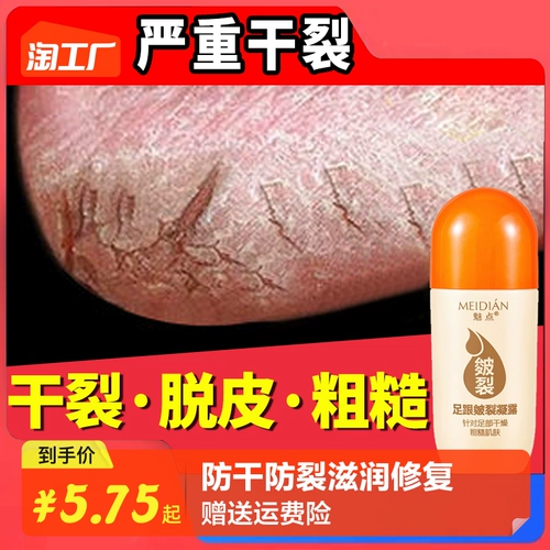 Напяточники, увлажняющий питательный восстанавливающий крем для рук, против трещин, пилинг