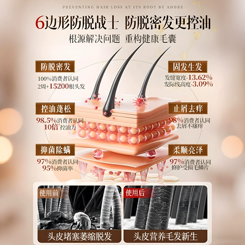 Водостойкий шампунь с имбирем, крем подходит для мужчин и женщин, антиалопеция, контроль жирного блеска, придает объем, удаление перхоти, против зуда