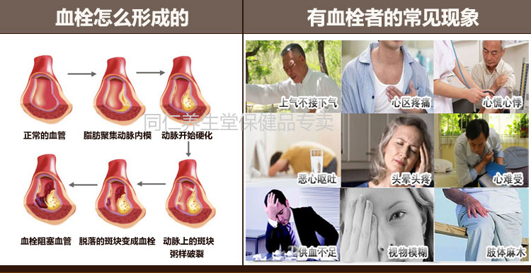 Jin Aolina Bean Kinase Red Ye viên 100 viên nang sản phẩm chăm sóc sức khỏe làm dày mỡ máu có thể dùng thuốc tan huyết khối nhồi máu não - Thực phẩm sức khỏe tảo xoắn nhật