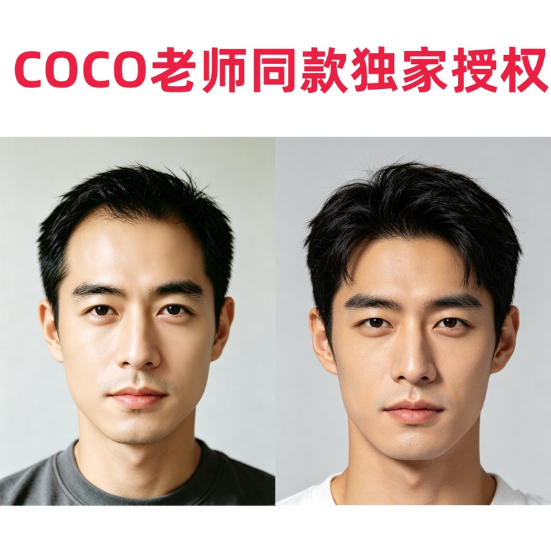 Men's Wig Forehead Patch, Exclusively Authorized by Coco Teacher, Genuine Product Authorized by Cmc