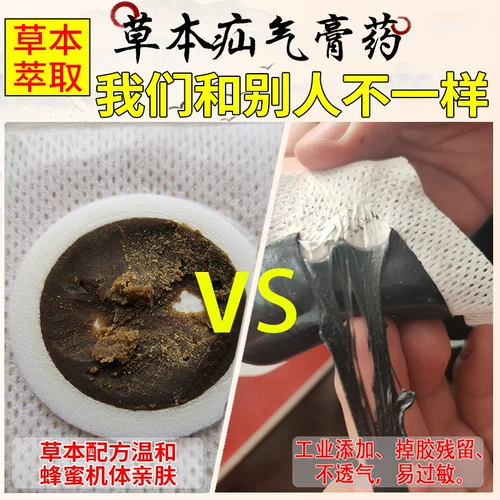 忆林 Hernia Stickers в пожилом паху, пожилые наклейки с пуповиной грыжей Взрослые дети -дети.