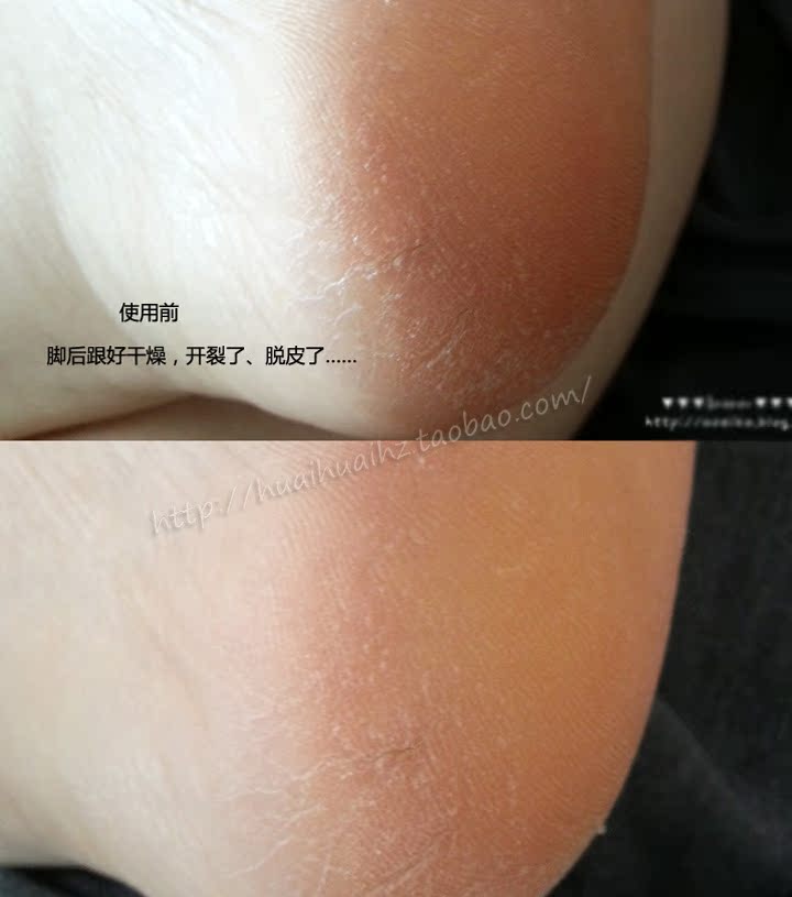 Clearance Mystery Still Ginger So nhẹ Foot Moisturising Cream Foot Cream Làm dịu dưỡng ẩm Anti-Cream 120ml kem dưỡng da chân