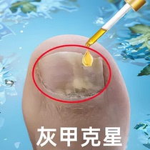 (Watson’s best-selling product) Removes bad nails and turns them into good nails. Painless nail removal. Suitable for both hands and feet. Hot-selling 100000 yuan.