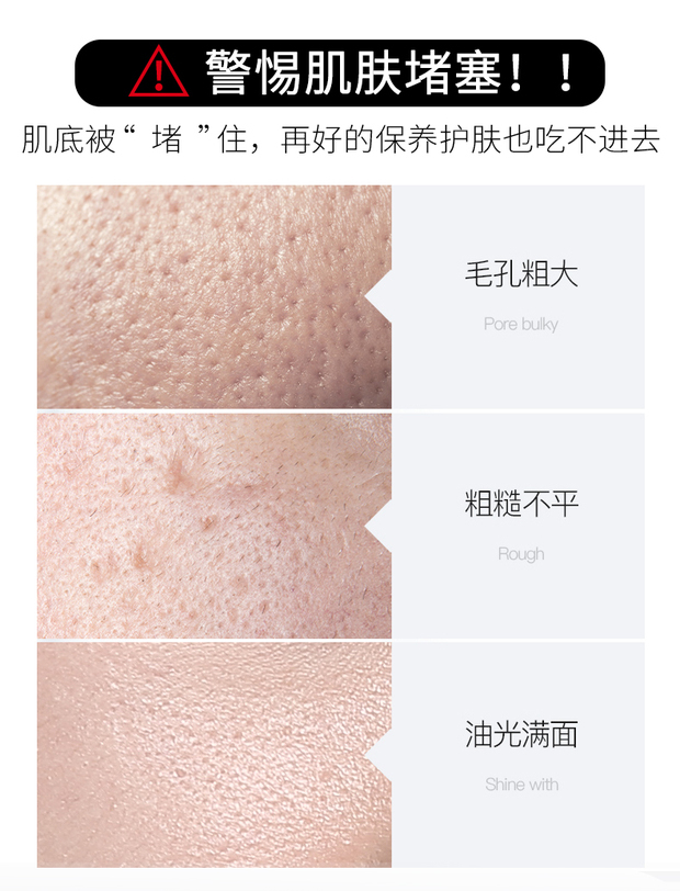 Làm sạch sâu lỗ chân lông độc tố rạng rỡ làm sạch da để làm bẩn những thứ bẩn kem massage vi tinh thể xác thực - Kem massage mặt kem massage mặt