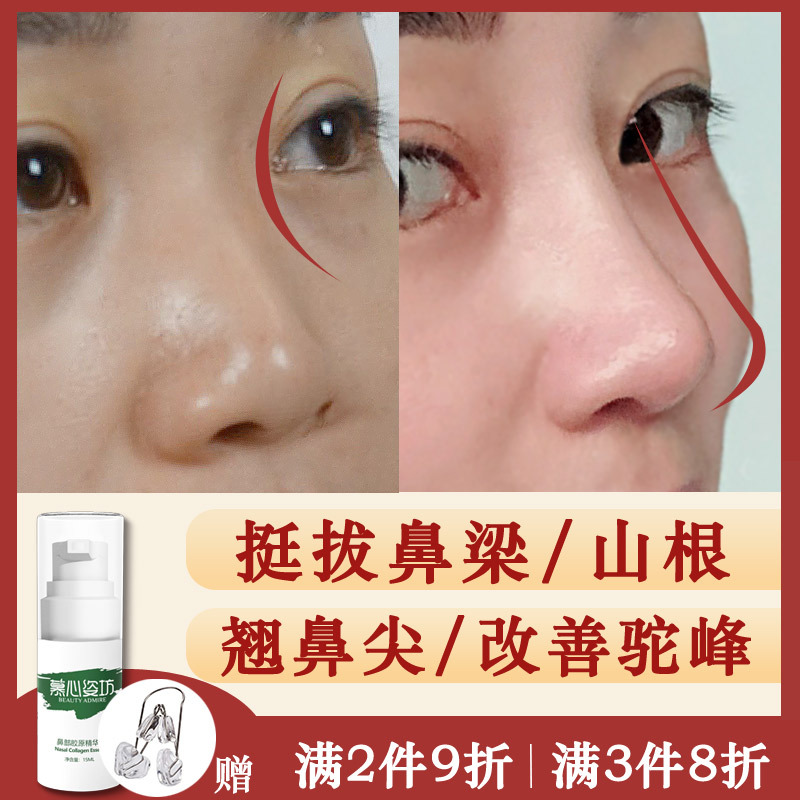 Nose Bridge Heightening Device, Nose Bridge Enhancement Serum, Nose Beauty Essential Oil, Nose Shaping Tool, Nose Tip and Wing Reduction