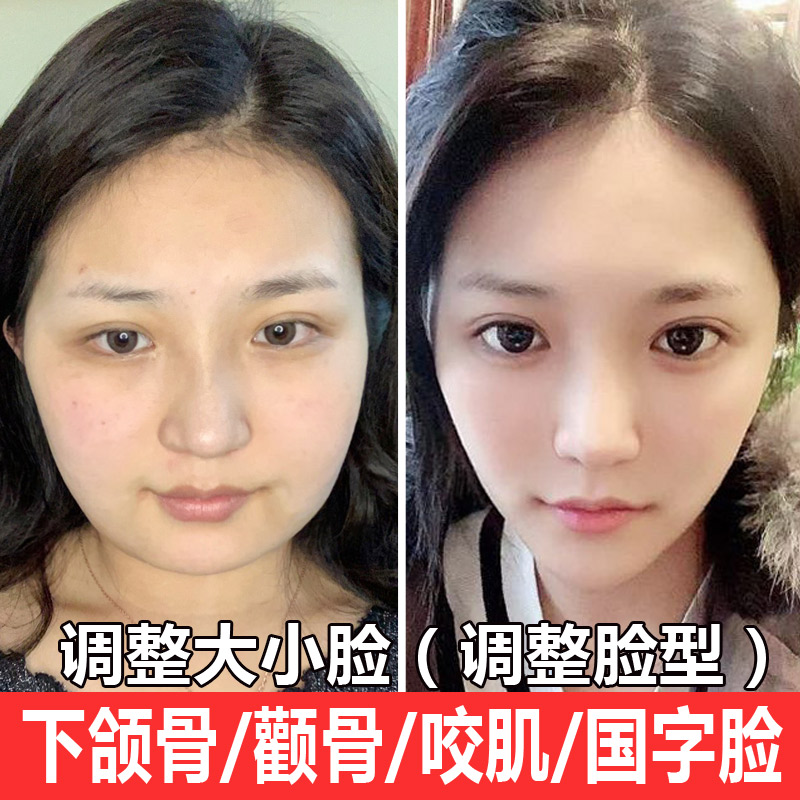 Anti-cheekbone essence underwater jaw to masseter muscle size Chinese character face push shrinkage protruding correction artifact to send slimming face instrument