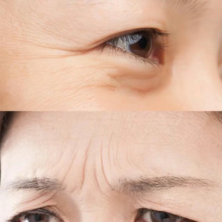 Japan's popular Sichuan pattern patch to remove eye wrinkles and nasolabial folds, firming and fine-tuning patch