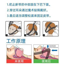 Chin rear shrink aligner Zhangkou Respiratory correction with sleep Shut up Divine Instrumental Anti-Zhang-mouth Bato with children