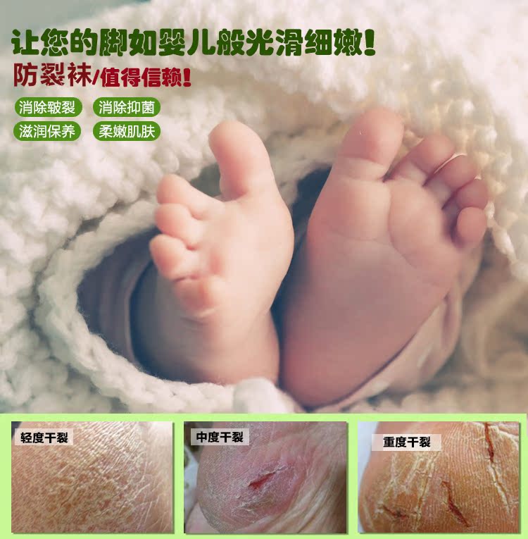 Bít tất chân nứt chân nứt chân chống khô chocks mẫu nam nữ vớ cotton mỏng chống gót chân nứt nẻ quần tất nữ Hàn Quốc