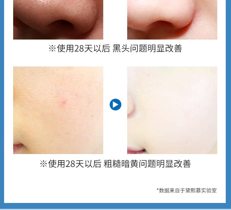 2018 thu nhỏ lỗ chân lông cứu tinh chất sửa chữa lỗ chân lông để trị mụn đầu đen nam nữ thu nhỏ dưỡng ẩm tinh chat tri mun doctor care