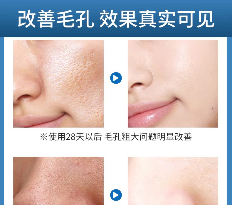 2018 thu nhỏ lỗ chân lông cứu tinh chất sửa chữa lỗ chân lông để trị mụn đầu đen nam nữ thu nhỏ dưỡng ẩm tinh chat tri mun doctor care
