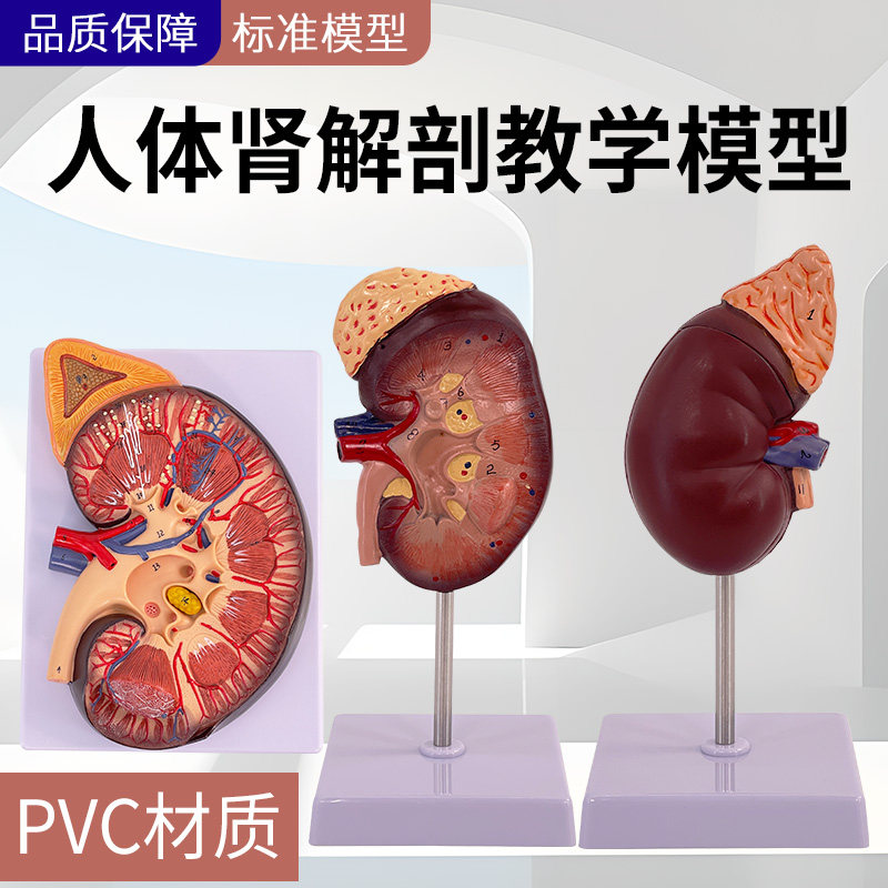 人体肾脏模型 肾解剖附肾上腺放大模型病变肾脏 人体内脏器官解剖