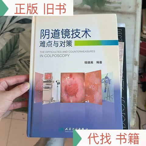 Vaginoscopy: Technical Challenges and Solutions Hardcover by Qian Deying, People's Medical Publishing House