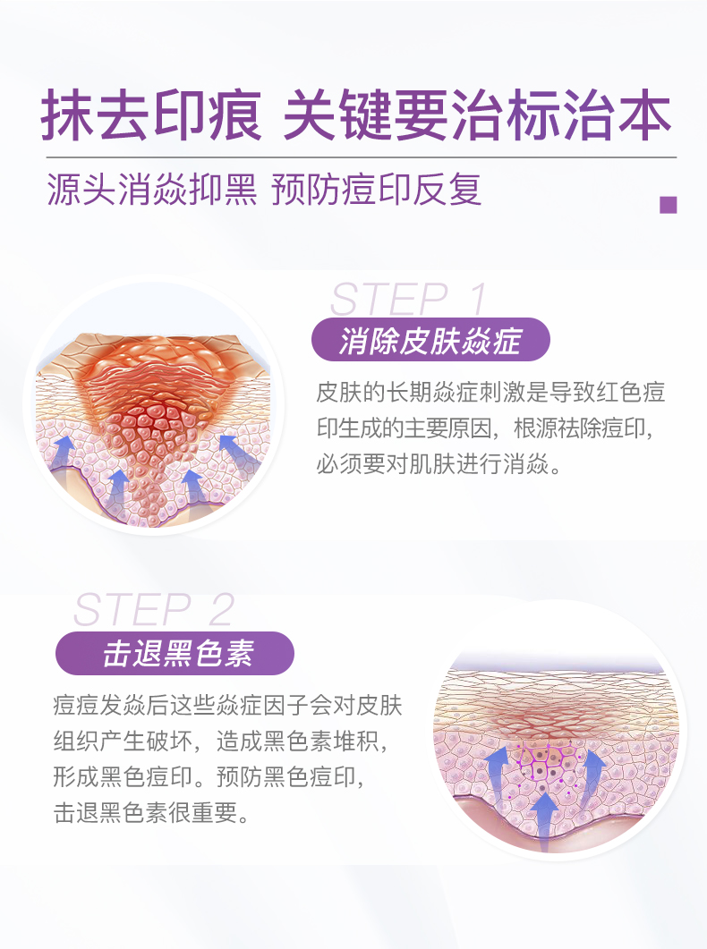 【HS】贺柏圣淡痘印修复咀嚼片