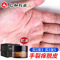Hand Peeling Repair Cream Seasonal Palm Metaskin Severe Dry Cleft Vitamin Fades Peel Off Peel Burst Peel Crack Open