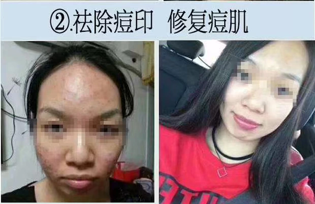Chính thức xác thực nuôi dưỡng trẻ hóa da mặt độc tố massage mặt kem kem làm sạch sâu lỗ chân lông