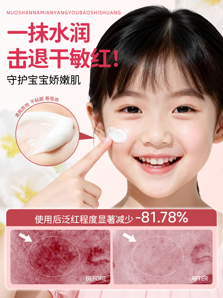 100% Australian Imported Sheep Oil Children's Face Cream Moisturizing and Nourishing Baby Cream Infant Lanolin Cream Moisturizing Lotion Genuine