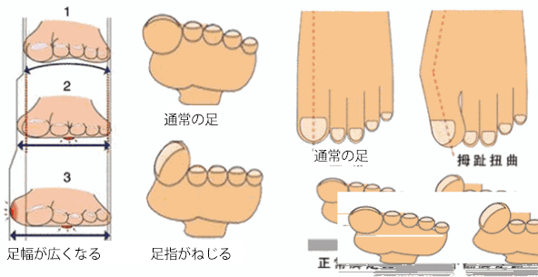 P_045.gif