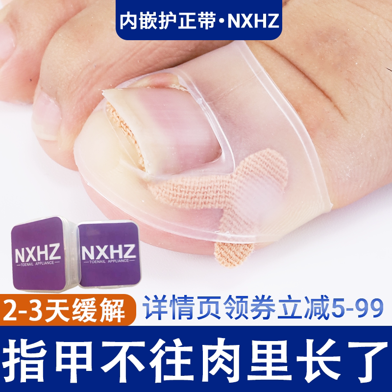 Ingrown Nail Device Embedded to Protect Nxhz Ultra-Thin German Bs Correction Artifact Patch for Nails with Long Flesh