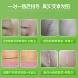 Shu Scaring Starmovation Sticker Sticker Inspiran