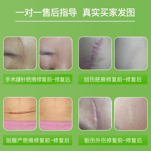 Shu Scaring Starmovation Sticker Sticker Inspiran