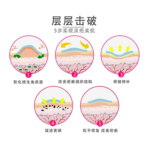 Наклейка с удалением медицинской рубки послеродовой наклейка на рубце гиперплазию двойное восстановление рука