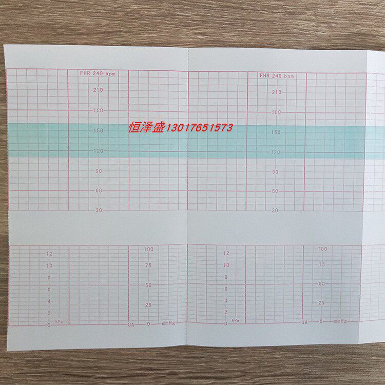 添印胎监打印纸150*90 150P家用保健耗材适用科曼监护仪