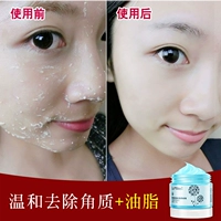 Tẩy tế bào chết cho cơ thể Gel tẩy tế bào chết toàn thân tẩy tế bào chết ngọc trai