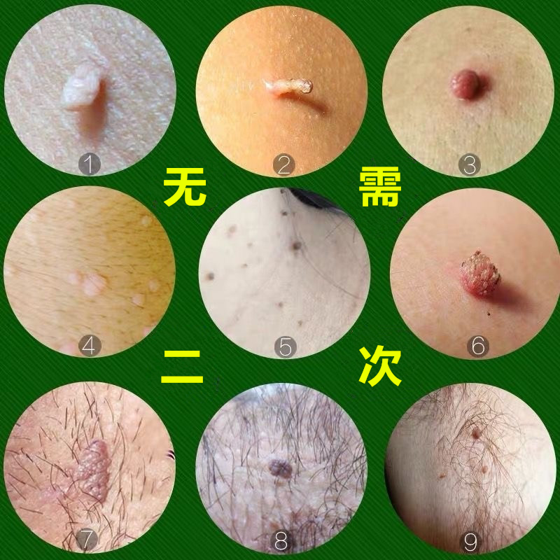 揭秘胖东莱大肚贴：减掉赘肉的秘密