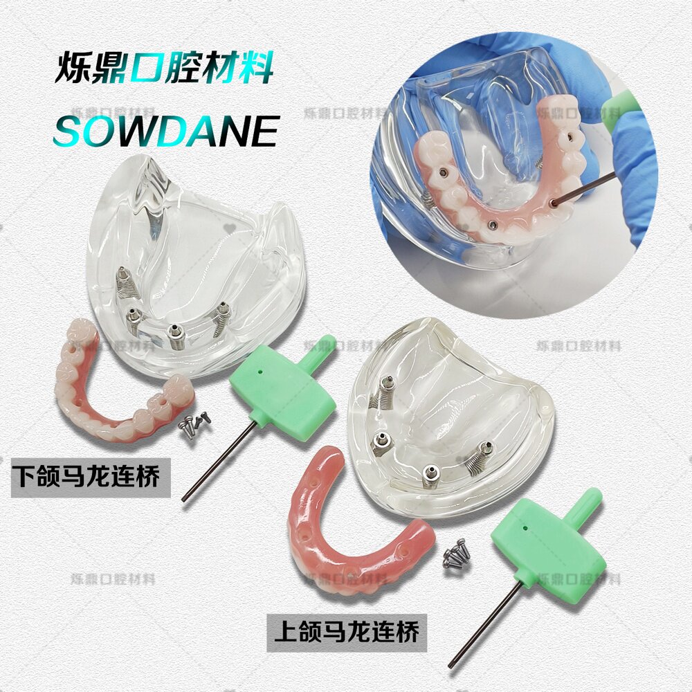 牙科口腔教学模型马龙连桥义齿修复模型仿真义齿种植模型
