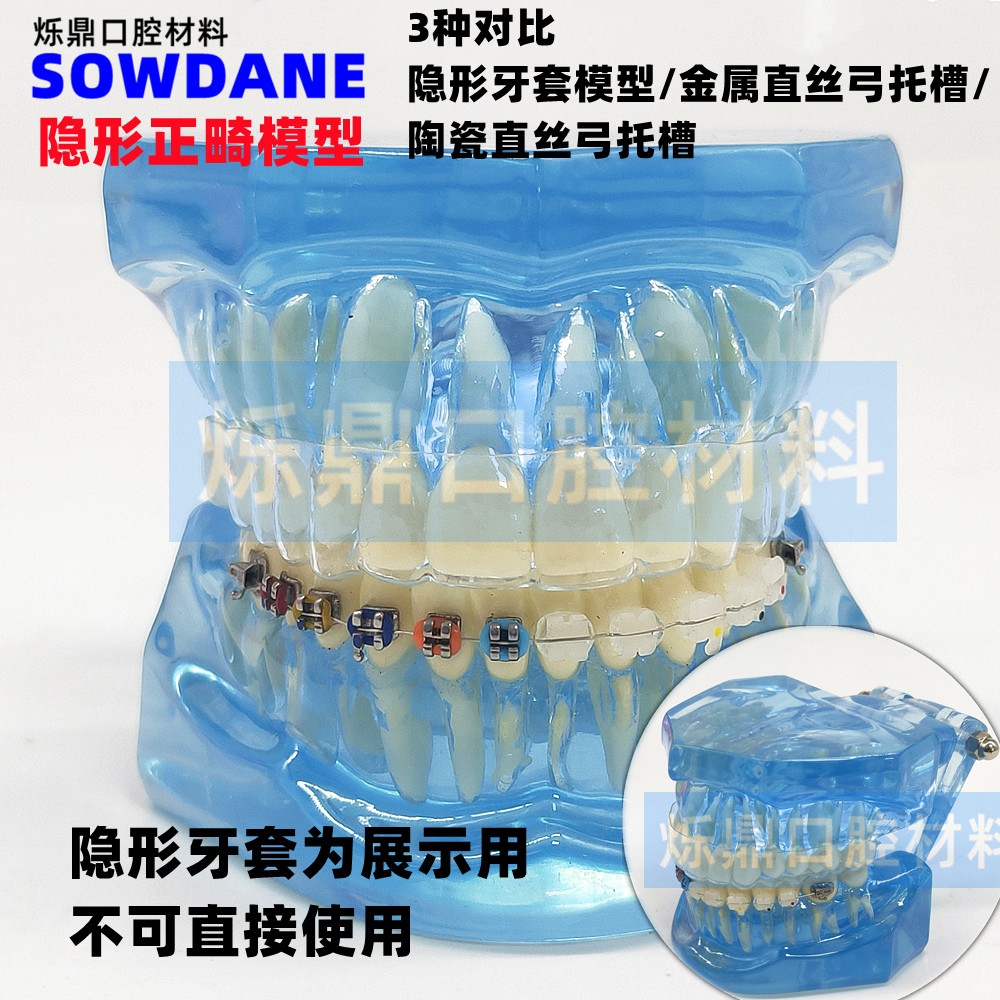 牙科隐形正畸模型3种对比矫正牙模金属托槽陶瓷托槽对比齿科护理