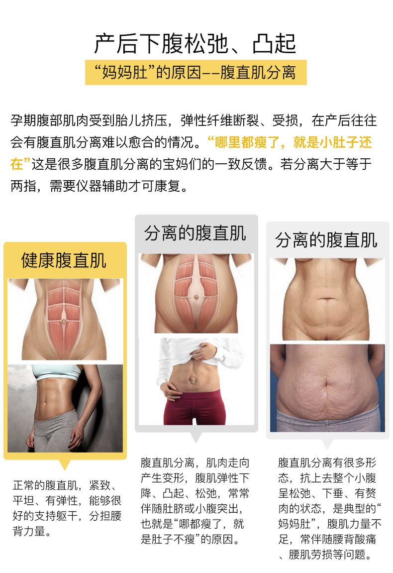 腹直肌分离修复产后大肚腩英国tenscare医而维产后腹直肌修复仪 Tenscare Tenscare旗舰店 Tenscare腹直肌官网