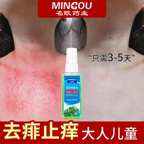 Name Eu Liquid Refreshing Powder Honeysuckle Hot Prickly Water To Prickly Prickly Anti-Prickly Mosquito Repellent Spring Summer Special Adult Student Universal