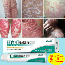 Lingling Ai Wan Ke Shu Hengfeng official Kang Shu Ai Miao Newt private itch cream Tomson Moridi wet itch cream