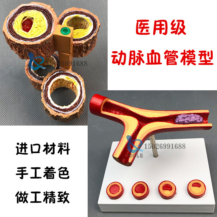 人体支脉粥样/硬化心血管动脉/硬化模型血栓模具人体动脉血管教具