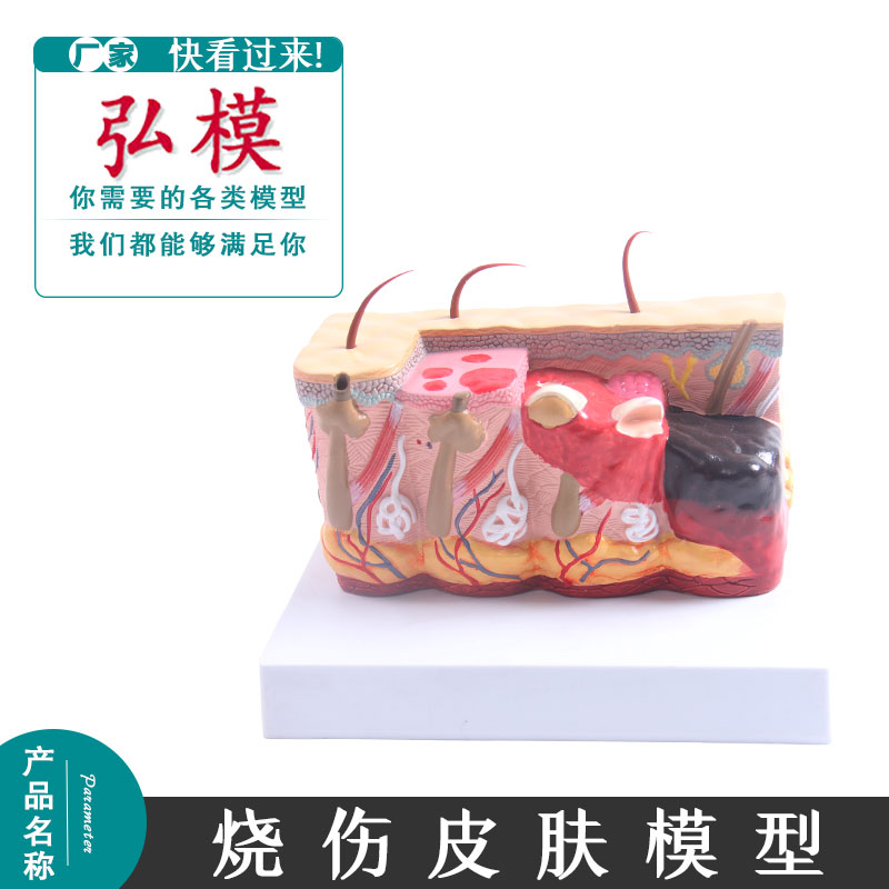 人体皮肤模型 放大 医用美容整形 皮肤科教学使用 烧伤皮肤模型