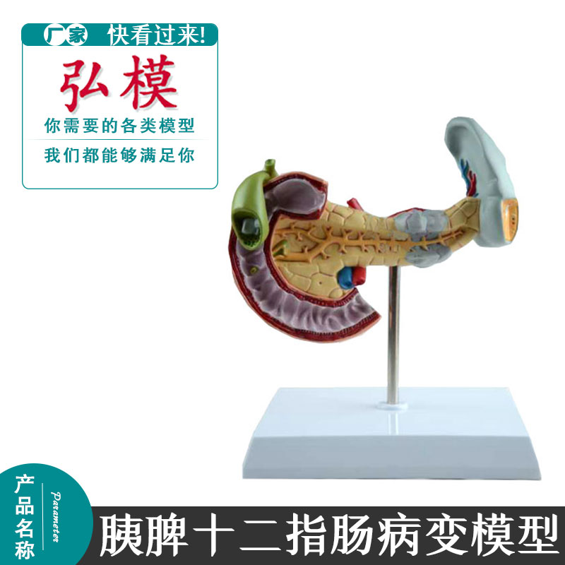 弘模胰腺十二指肠和胆囊病理模型消化系统消化科模型人体解剖模型