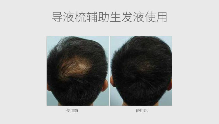 1812A详情页-修改生发禁用词_10