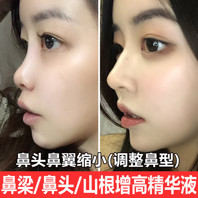 Nose-Lifting and Beautifying Tool, High Nose Bridge, Nose Heightening and Straightening Essence, Slimming Nose Tip, Reducing Nose Wings, Essential Oil