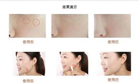 Bút che khuyết điểm hai đầu Hàn Quốc VOV được xóa sạch Thích hợp cho các đốm nhỏ vùng mắt Các vết mụn trứng cá mắt đen che khuyết điểm tốt