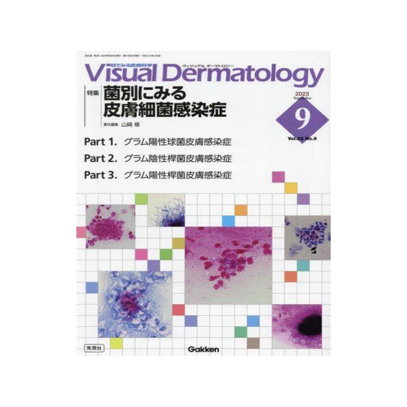 Visual Dermatology: 目でみる皮膚科学 (2023年9月号 Vol.22 No.9) 山?修 Visual Dermatology: 目でみる皮膚科学 (2023年9月号 Vol.22 No.9)