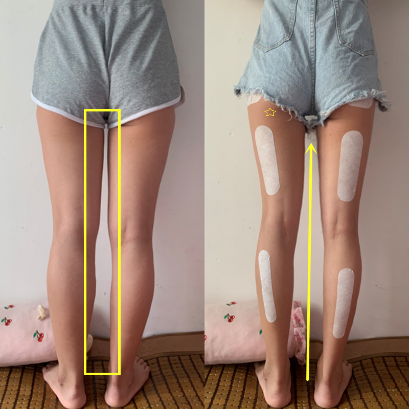 Say goodbye to body fat, beautiful legs exposed, during lactation available Buy 3 Get 2 Buy 5 Get 5 Free Watsons Hot Sale