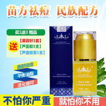 Shengxing Miaoshan Doudou liquid acne water Acne india acne pit repair water essence Male student acne water