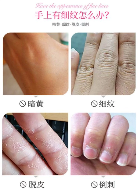 Xue Lingling Rose Hand Mask Whitening Moisturising Găng tay làm đẹp cho người già chăm sóc da tay