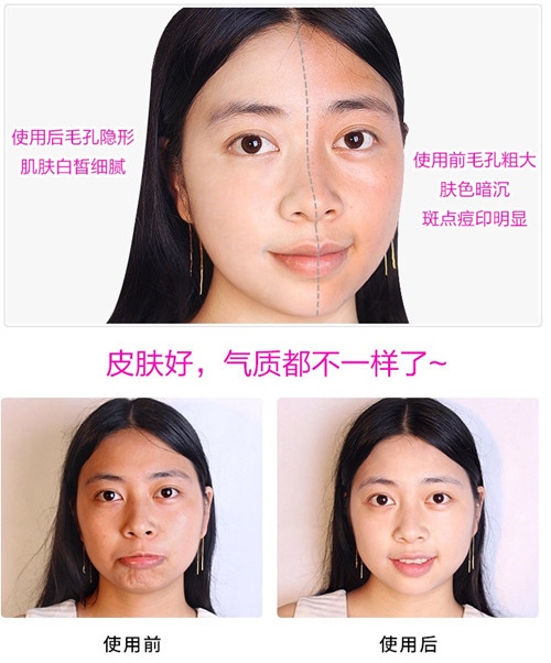 Kem dưỡng da nhạy cảm BB cream Korea tifi medipeel da liễu che khuyết điểm đặc biệt kem nền bb collagen cellio